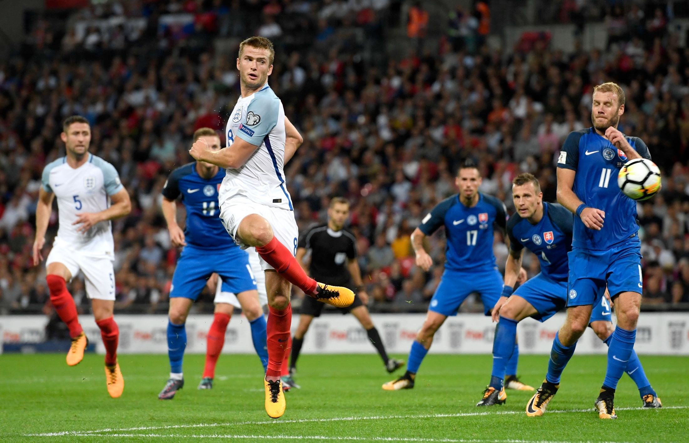 南野拓实法国杯受伤被担架抬出场，疑似遭遇重伤（法国杯南野拓实伤退，被担架抬离赛场疑似重伤）